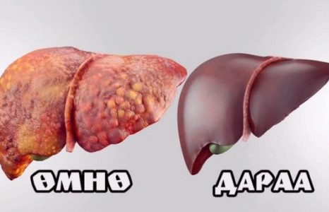Элгийг 3 сарын дотор бүрэн цэвэрлэх шидэт дэглэм