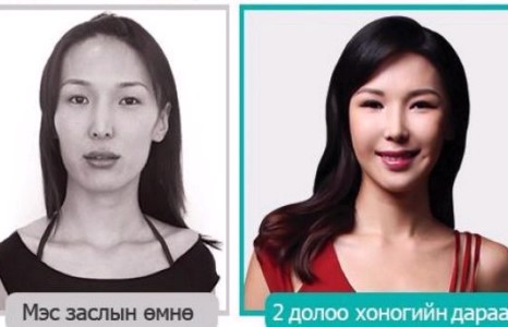 Мисс Э.Сэлэнгэ гоо сайхны хагалгаанд орсон мөнгөө ингэж олов