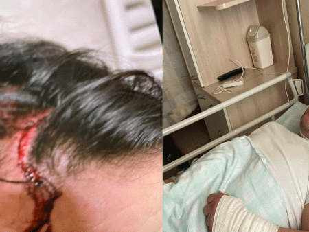 Эрэн сурвалжлагдаж байсан Н.Түвшинбаяр томоохон хувийн эмнэлэгт эмчлүүлж байна