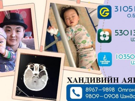 А.Бэлгүнтэй хүүд амьдрал бэлэглэцгээе