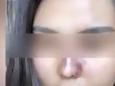 Хамар өндөрлөх филлер тарилга хийхдээ үйлчлүүлэгчийнхээ эрүүл мэндэд нь хүнд хохирол учруулсан байна