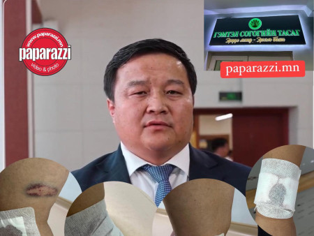 Р.СЭДДОРЖ:  Өнөөдөр маш харамсалтай үйл явдал боллоо.  Гурван хүүхдийн ээжид хөдөлмөрийн чадвартай болж ажил үүргээ хэвийн гүйцэтгэх хүртэл нь тусламж дэмжлэг үзүүлнэ.
