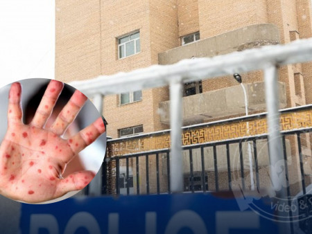 Н.Сувдмаа: Улсын хэмжээнд өнөөдрийн байдлаар улаанбурхан өвчний 66 тохиолдол батлагдаад байна