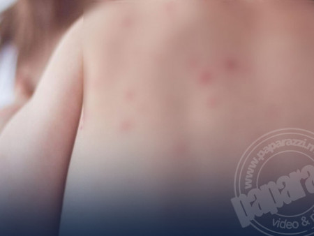 ХӨСҮТ: Улаанбурханы халдвараар өвчилсөн 4 сартай хүүхэд өнөөдөр үүрээр эндсэн