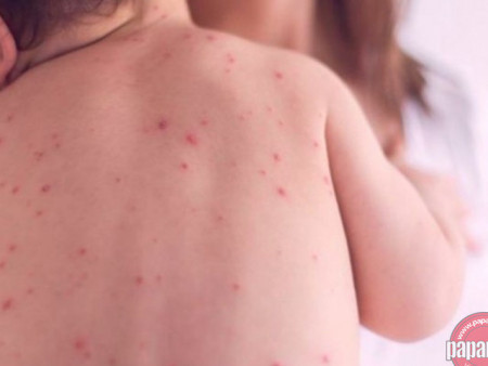 ХӨСҮТ: Улаанбурханы дархлаажуулалтын цэг ХӨСҮТ-ийн хүлээн авах яаралтай тусламжийн хэсэгт 24 цагаар ажиллаж байна