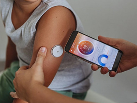 Нэгдүгээр хэв шинжийн чихрийн шижинтэй 260 хүүхдийг сенсор буюу CJM төхөөрөмжөөр хангана