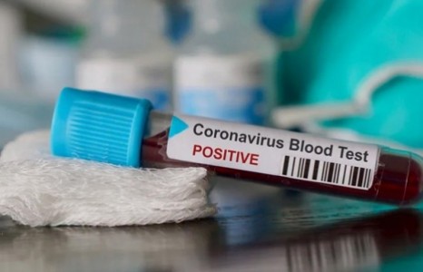 News paparazzi : ХӨСҮТ-д тусгаарлагдаж байсан нэг хүнээс 